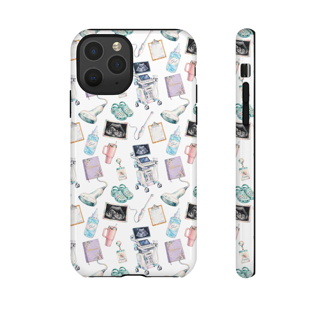 Watercolor Ultrasound Tech White iPhone Case — iPhone 11-17